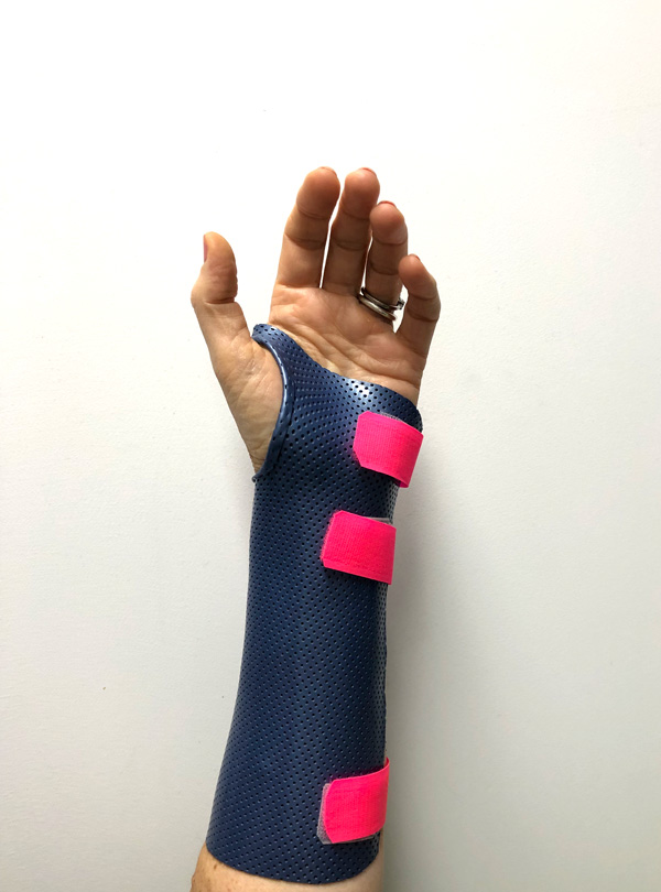 Waterproof Casts – Peninsula Hand Therapy