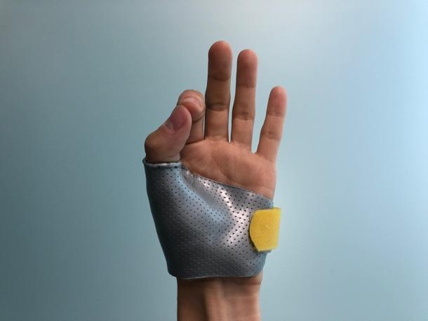 splint peninsula hand therapy